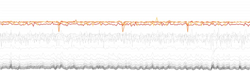 solutions-iot-monitoring-outlier-detection-crop.png